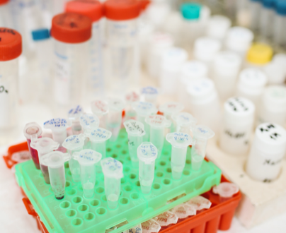 呼吸疾病生物资源库共享平台